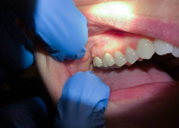 Best Cosmetic Emergency Dentistry in Grosse Pointe Farms, MI