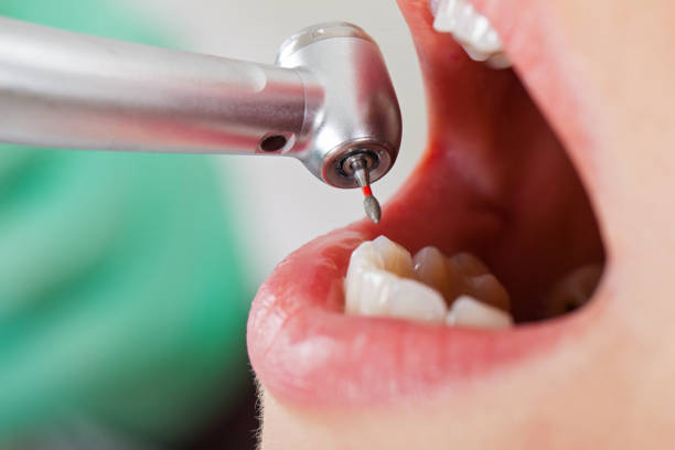 Best Urgent Care for Lost Fillings or Crowns in Grosse Pointe Farms, MI